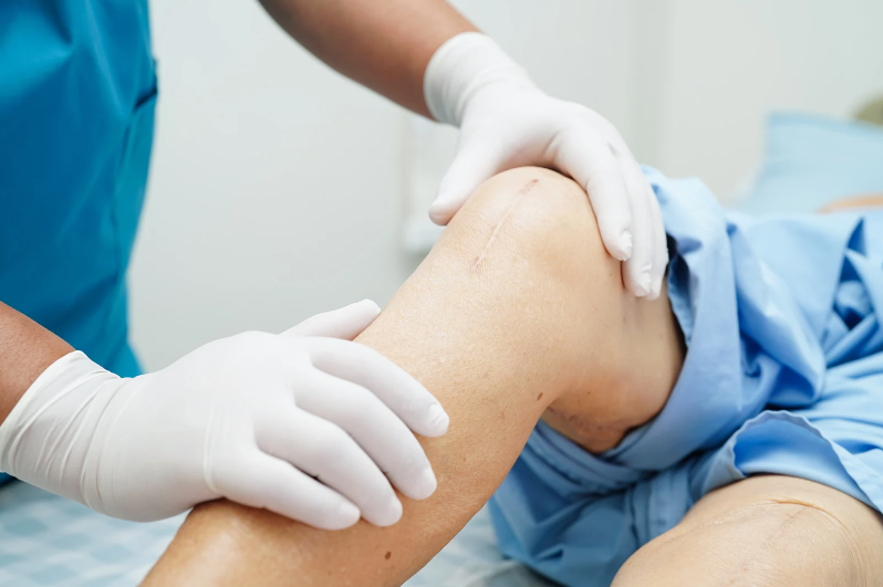 Affordable Knee Surgery A Practical Guide to Cost-Effective Treatment Options