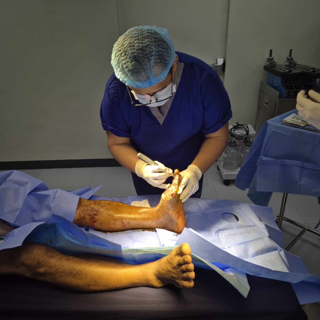 Everything You Need to Know About Debridement Services in Quezon City